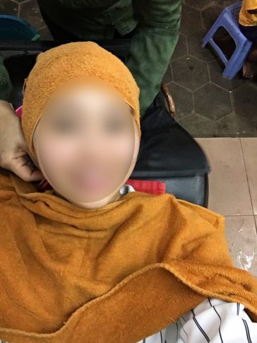 カンボジアの肌事情_170922_0032_bokashi